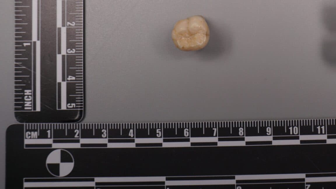 Protein in Homo erectus teeth suggests Denisovans gave us some of their DNA