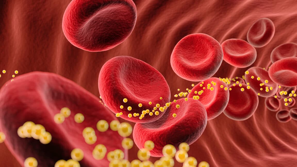Bad cholesterol slashed 62% by single dose of gene-editing drug in small trial