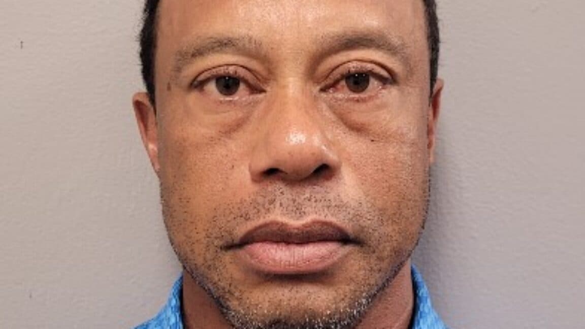 Sweaty, glassy-eyed Tiger Woods blames cell phone use for his car crash